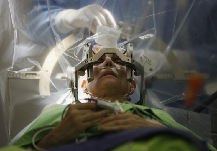 Deep Brain Stimulation neurosurgery