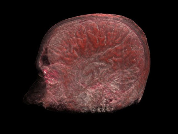 volume rendering of the brain