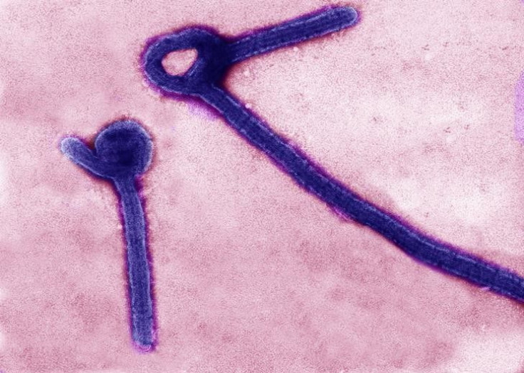 A transmission electron micrograph of the Ebola virus. 