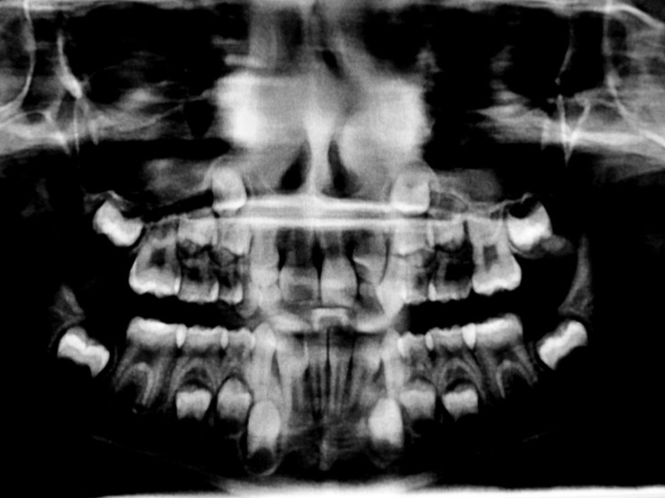 Tooth Regrowth