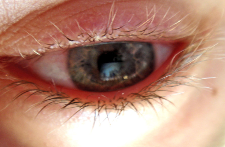 Close-up of eye