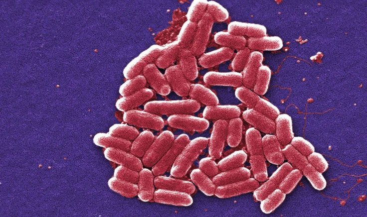A magnification of bacterium.