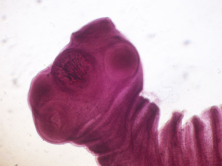 Scolex of pork tapeworm