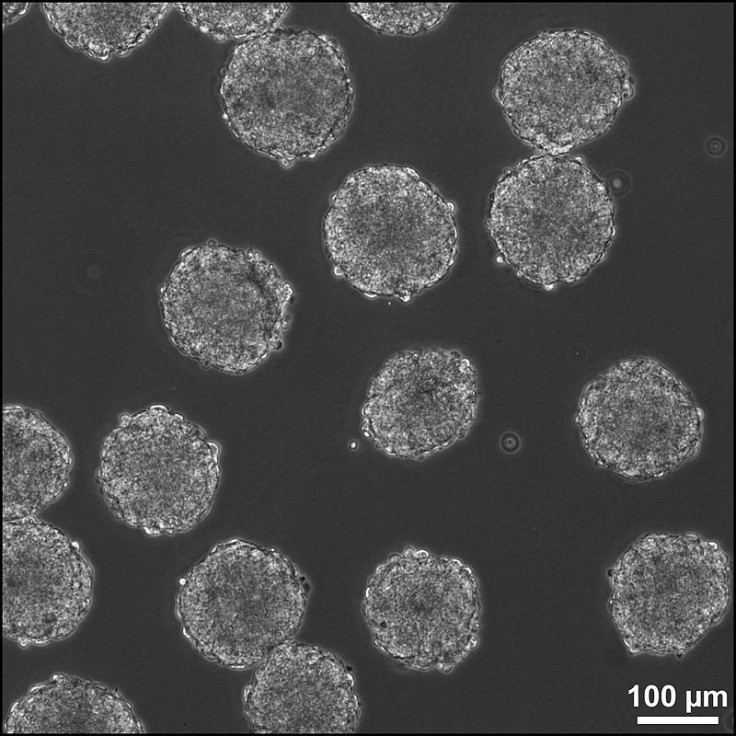 embryoid bodies