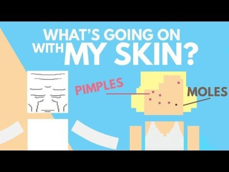 Why Do We Get Pimples? That And Other Skin Conditions, Explained 