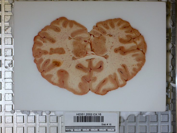 brain