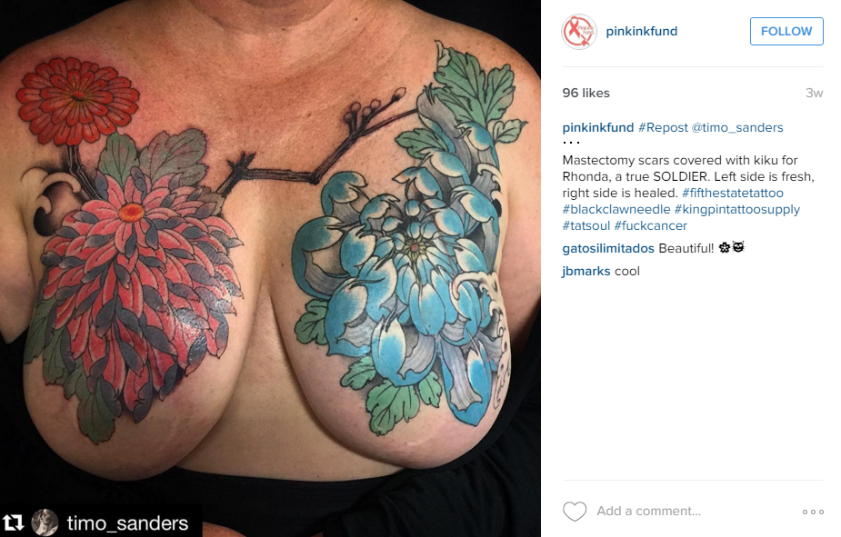 Mastectomy Tattoos with Artist Amy Black  Not Putting on a Shirt