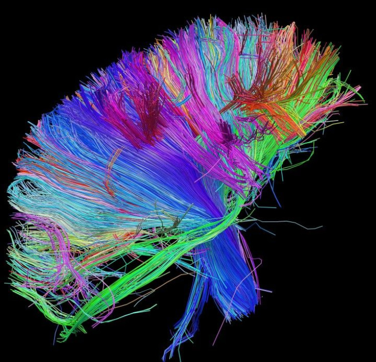 White Matter Fibers Brainstem and above