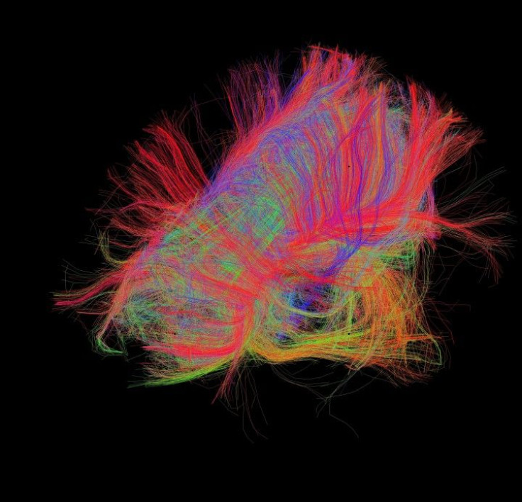 White matter fiber architecture of the brain