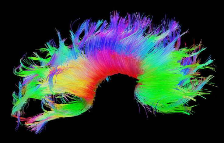 Corpus callosum, bottom angle