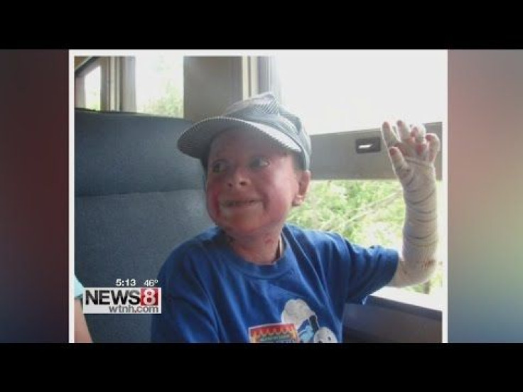 Connecticut Teen With Epidermolysis Bullosa, 'Butterfly' Skin Condtion, Gets To Live Out His Dream For A Day