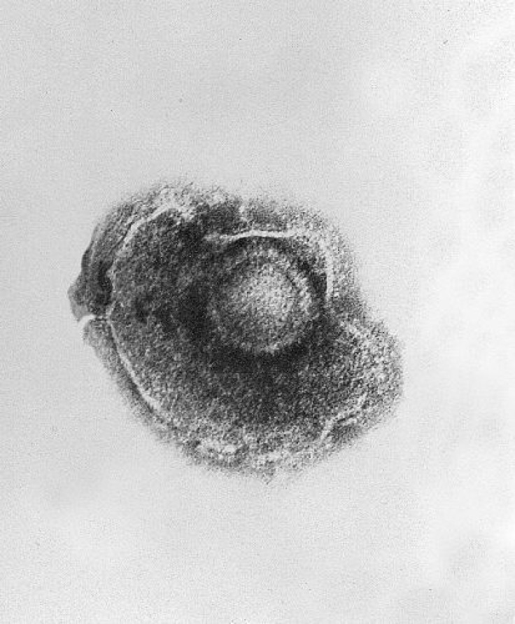 Varcella virus