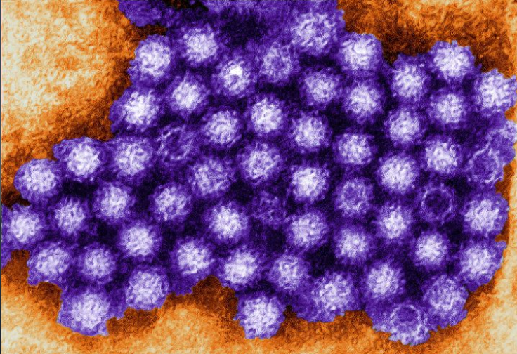 Norovirus outbreak