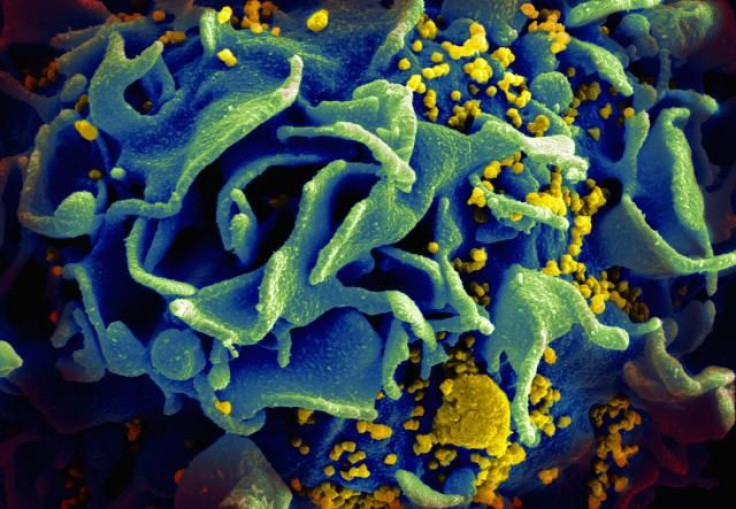 HIV-Infected T-Cell