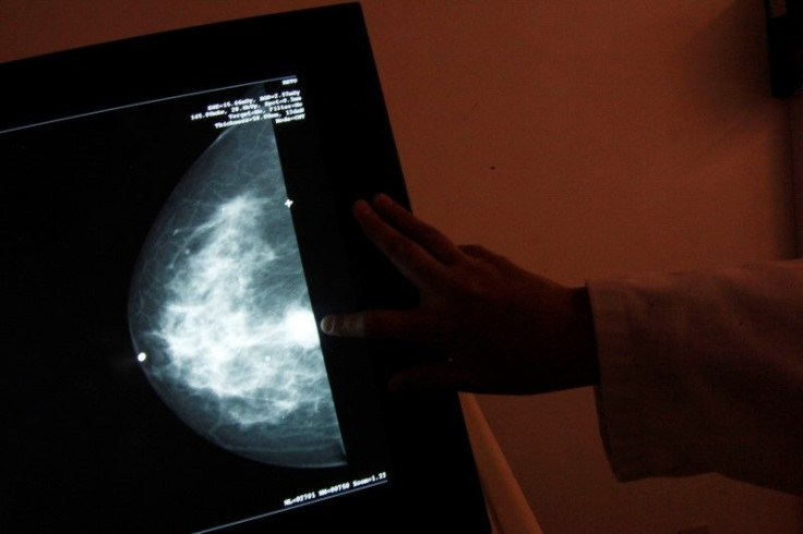 Mammogram guidelines