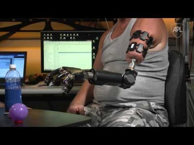 Targeted Muscle Reinnervation: Man Controls Prosthetic Arm With His Thoughts