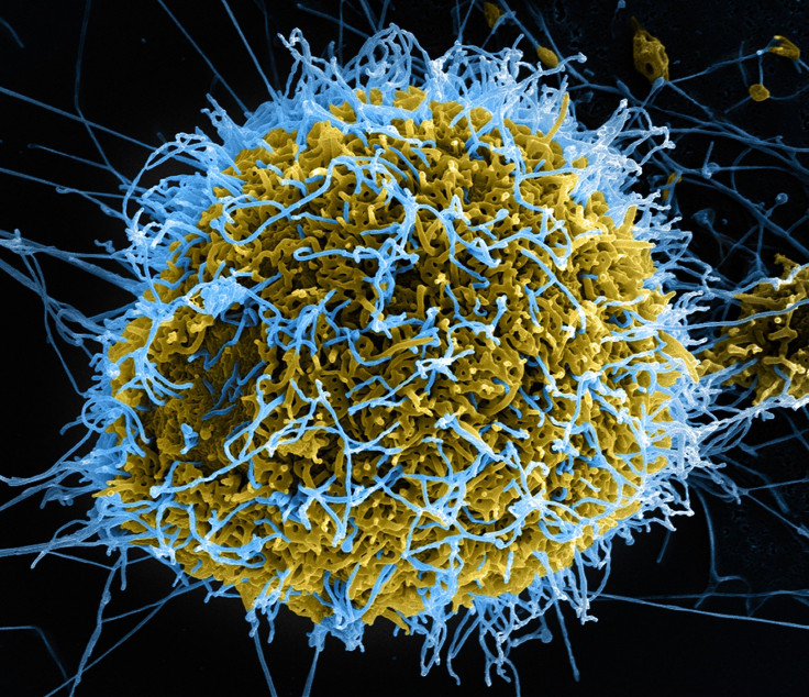 Ebola Particles