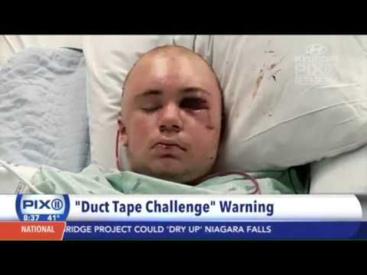 Duct Tape Challenge Gone Wrong: Teen Almost Died After Attempting Newest Internet Trend