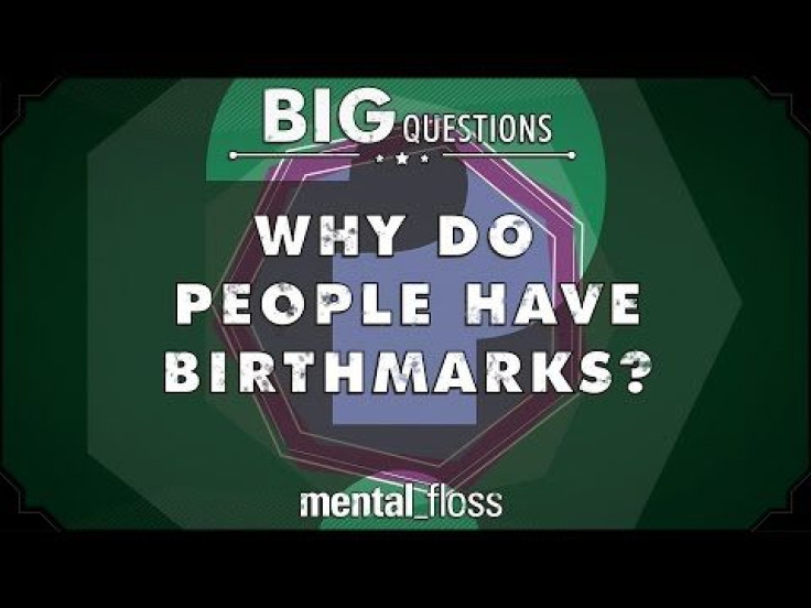 Why We Have Birthmarks: Spots On Skin In Newborns Form Via Extra Pigmentation, Clustered Blood Vessels