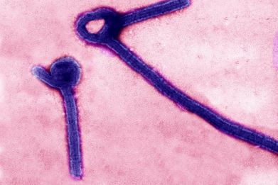 A transmission electron micrograph shows Ebola virus particles in this undated handout image released by the U.S. Army Medical Research Institute of Infectious Diseases (USAMRIID) in Fredrick, Maryland.