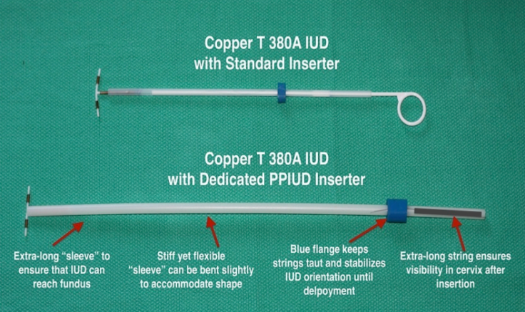 Postpartum IUD