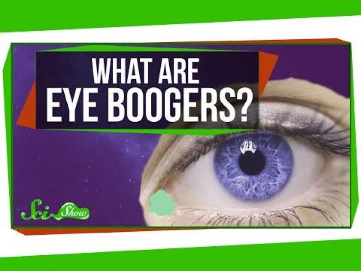 Eye Boogers