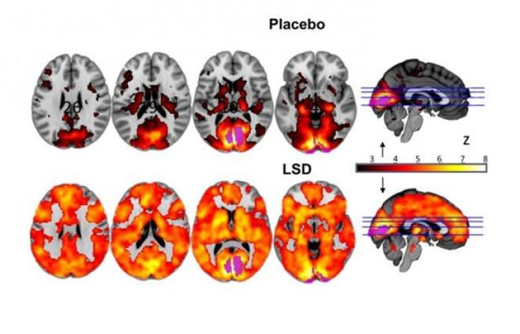 lsd