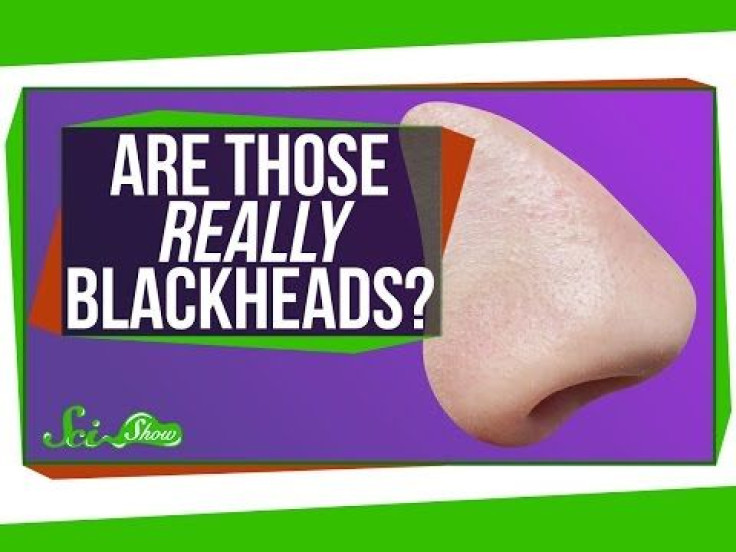 What You Think Are Blackheads May Just Be A Sign Of Perfectly Healthy, Clear Skin