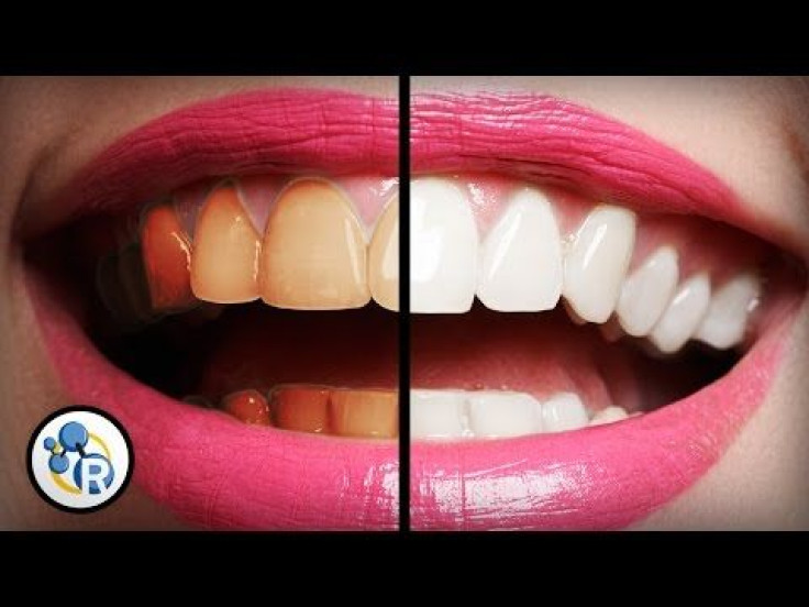 Which OTC Teeth Whitening Solution Is Best, And Are Any Of Them Truly Safe?