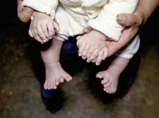 Polydactylism