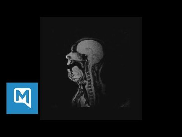 The Science Of Singing: MRI Scan Shows Baritone Opera Singer's Vocal Tract While Performing 'Tannhäuser'