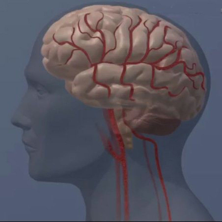 blood flow in the brain