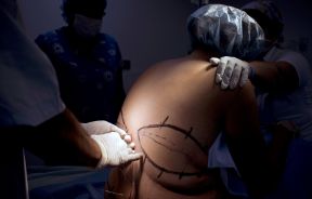 bariatric surgery