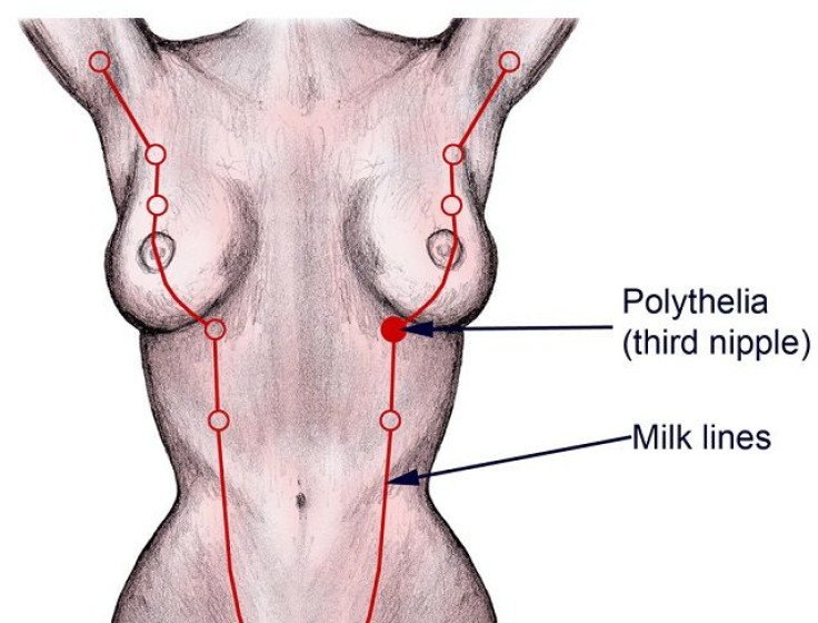 Milk Lines