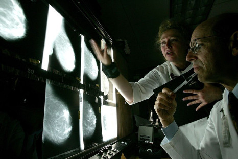 Dr. Edward Sickles and Larisa Gurilnik RT (who were not involved with the study) look at films of breast x-rays at the UCSF Comprehensive Cancer Center August 18, 2005 in San Francisco, California.