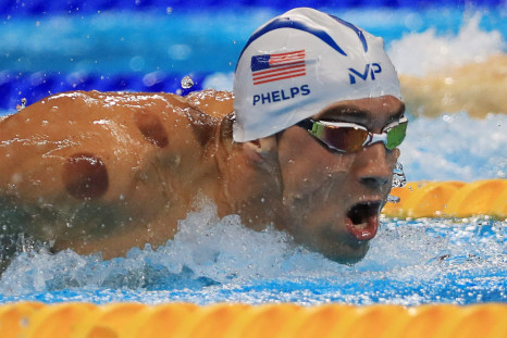 Michael Phelps of USA is seen with red cupping marks on his shoulder as he competes in the 2016 Rio Olympics.