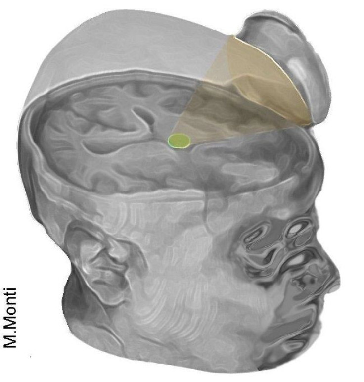 thalamus