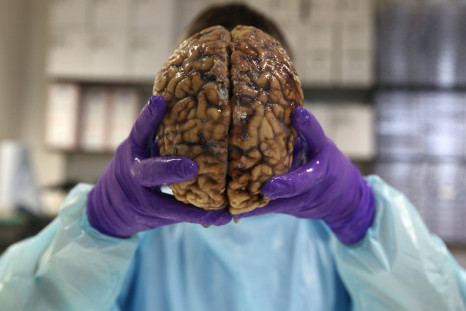 Prof. Steve Gentleman poses with a human brain at the Multiple Sclerosis and Parkinson’s UK Tissue Bank at Imperial College London, June 3, 2016.