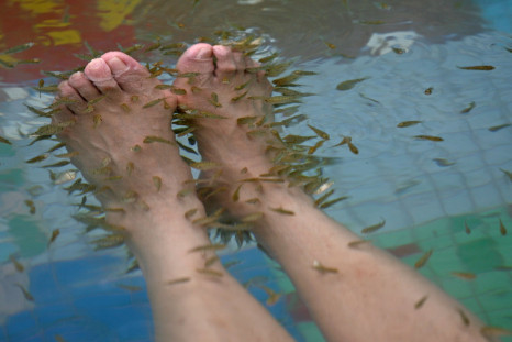 Doctor fish are freshwater fish traditionally used in areas of Turkey for treatment of skin diseases such as psoriasis; they eat the affected and dead areas of the skin, leaving the healthy skin to grow. Pictured: A tourist enjoys a therapy spa in a hot spring resort, home to 'Doctor Fish' in Chongqing Municipality, China, January 7, 2007.