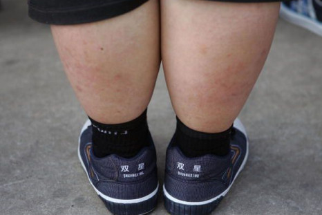 A new study has found that obese children are showing signs that they are at risk of developing serious health problems.