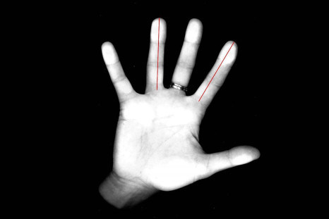 Researchers used a common photocopy machine to measure the lengths of the index and ring fingers of 42 women.