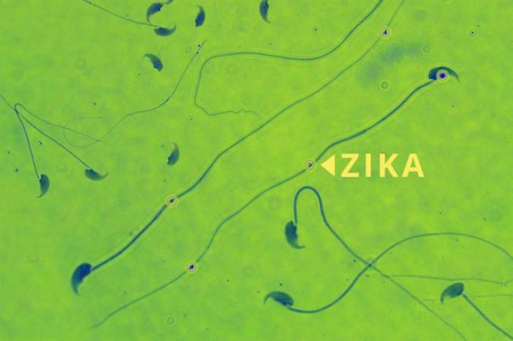Zika mouse sperm