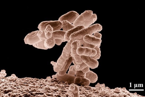 A new study points the finger at bacterial infections, not antibiotics, as a potential trigger of childhood obesity. Above, E. coli bacteria.