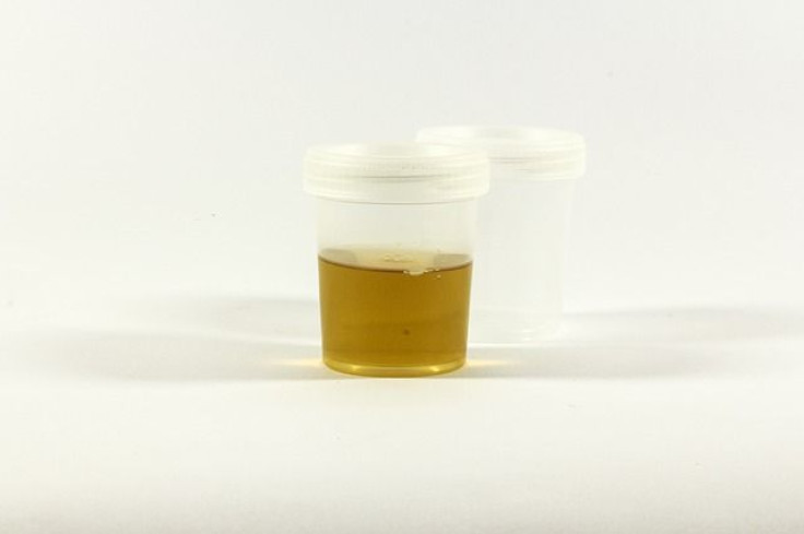 urine test