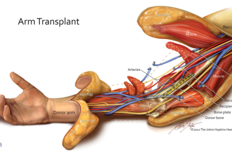 The nerves in the arm can take several weeks to regenerate.