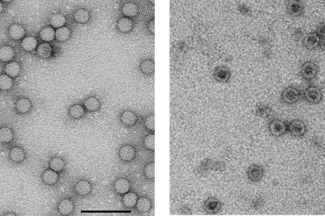 An image of live poliovirus particles, left, compared to empty particles to be used in a new vaccine. The virus-like particles on the right contain no infectious genetic material, and so the stain used fills the empty space making them appear black.