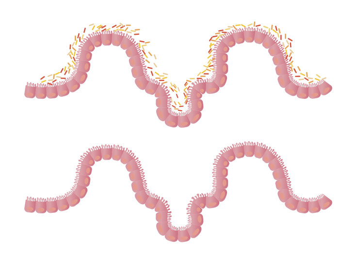 intestines - gut bacteria