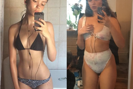 Emily Bador shows a comparison of her body at her thinnest, and her body now.