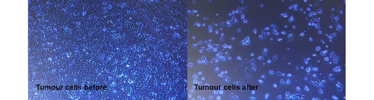 cd40-tumor-cells