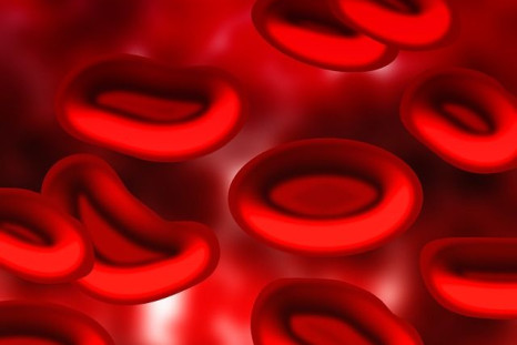 A new treatment cured about a third of blood cancer patients, and shrunk tumors in 82 percent of patients.